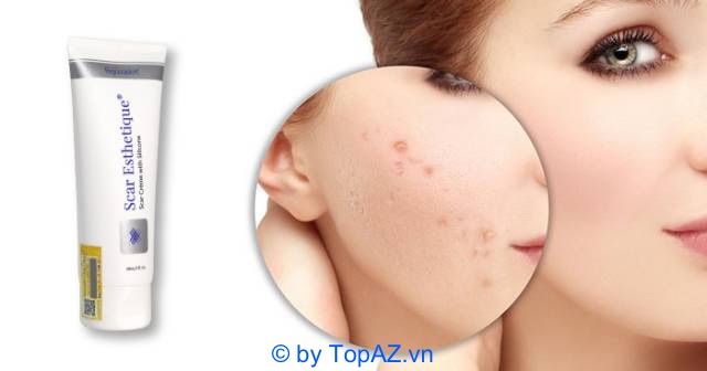 Kem trị sẹo Scar Esthetique