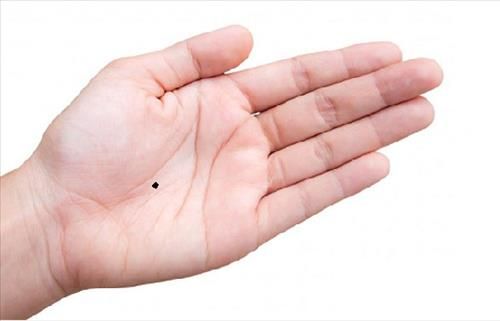 Sở hữu nốt ruồi phú quý này, bạn sẽ sống một đời không phải lo âu