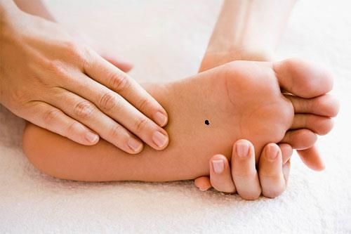 Nếu bạn có nốt ruồi phú quý này, cuộc đời bạn sẽ an yên không phải lo lắng