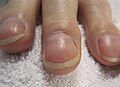 Quan sát từ phía trước
