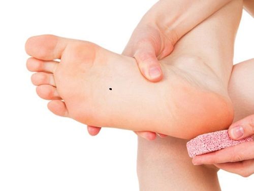 Khám phá những nốt ruồi mang lại sự phú quý và giàu có cho chủ nhân