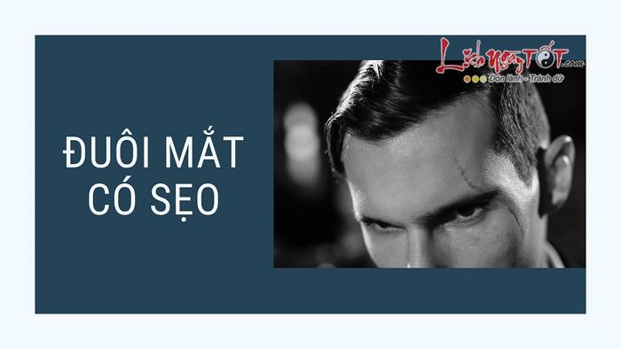 Sẹo phá tướng trên trán, sẹo ở đuôi mắt