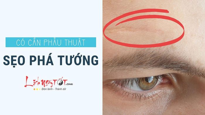 Sẹo phá tướng trên cơ thể