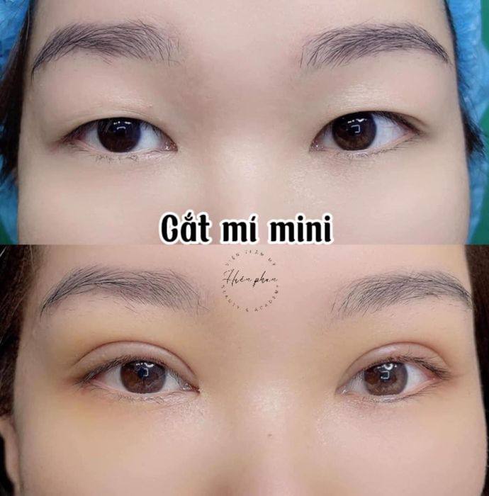 Hình ảnh Viện Thẩm Mỹ HIỀN PHAN 1