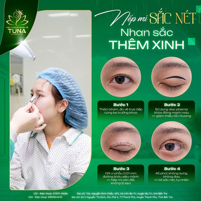 Hình ảnh Viện Thẩm Mỹ Quốc Tế TUNA 1