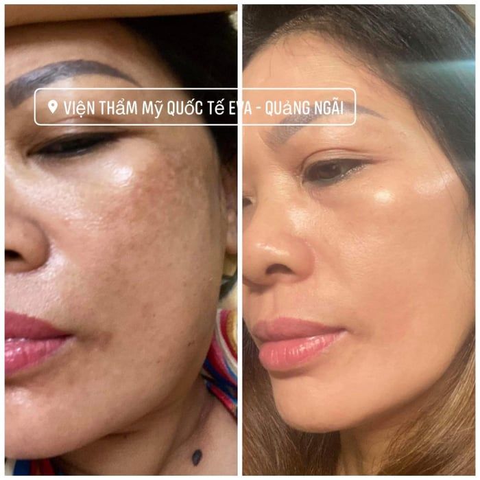 Hình ảnh Viện Thẩm Mỹ Quốc Tế EVA 1
