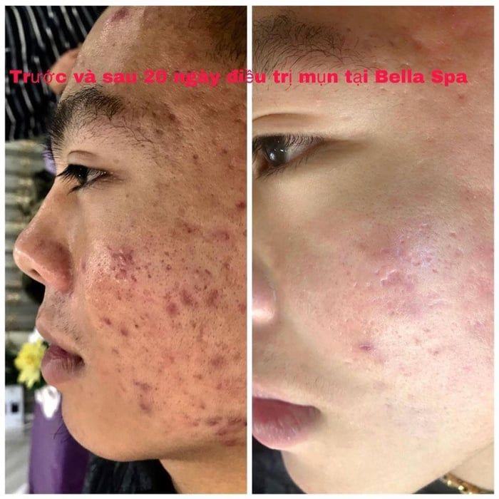 Hình ảnh tại Bella Spa