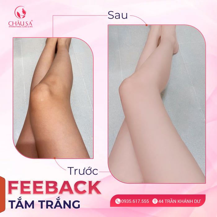 Hình ảnh Châu Sa Spa Gia Lai 1