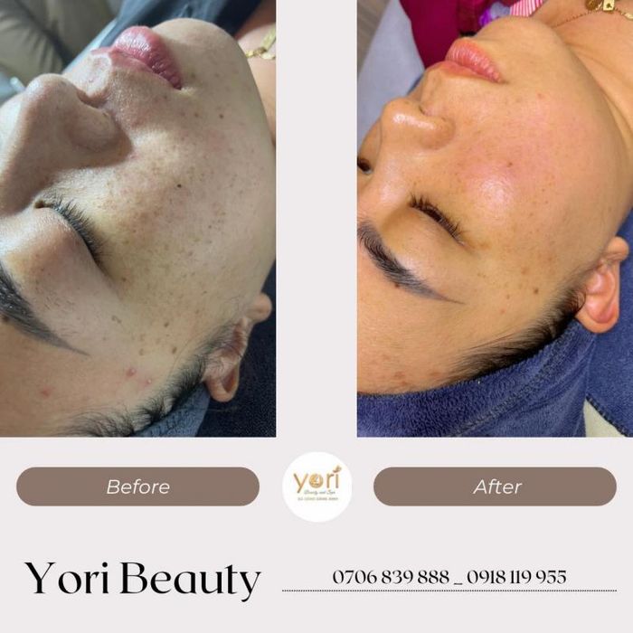 Hình ảnh Yori Beauty & Spa