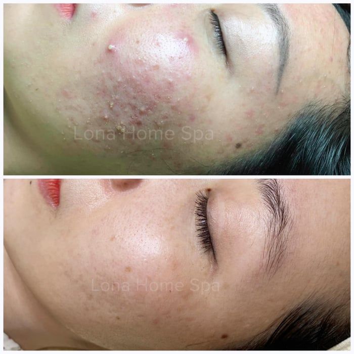 Hình ảnh Lona Home Spa Cần Thơ 2