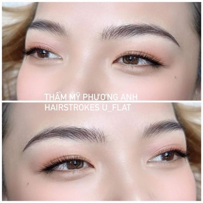 Hình ảnh Viện Thẩm Mỹ Phương Anh 1