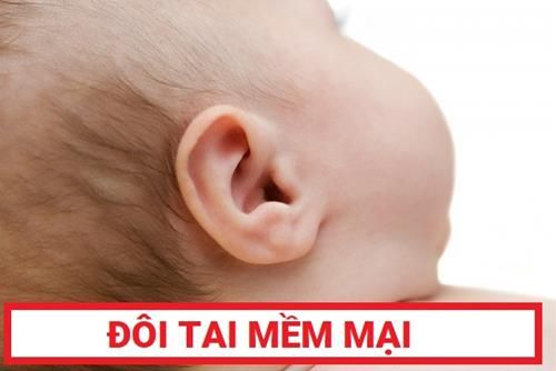 Tai mềm mại - Tướng trẻ em có tai