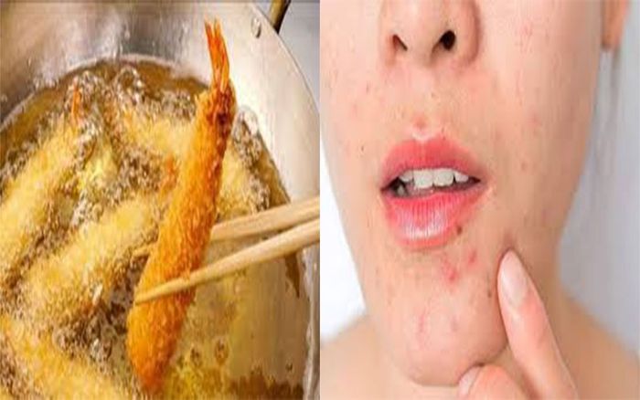 Hạn chế đồ ngọt và thực phẩm nhiều dầu mỡ ảnh 2