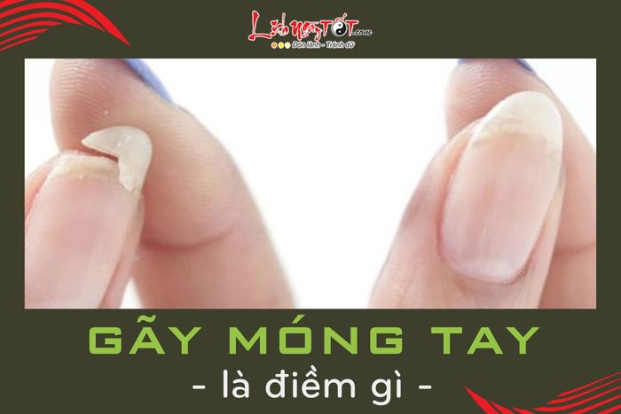 Dấu hiệu gãy móng tay