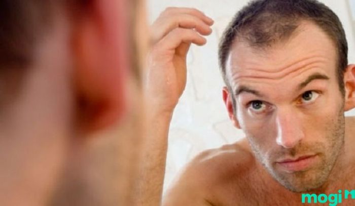 Ý nghĩa của trán chữ M