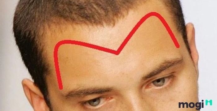 Cách nhận diện trán chữ M