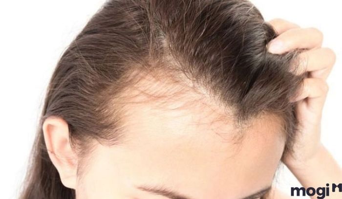 Vận số và tử vi của nữ giới có trán chữ M