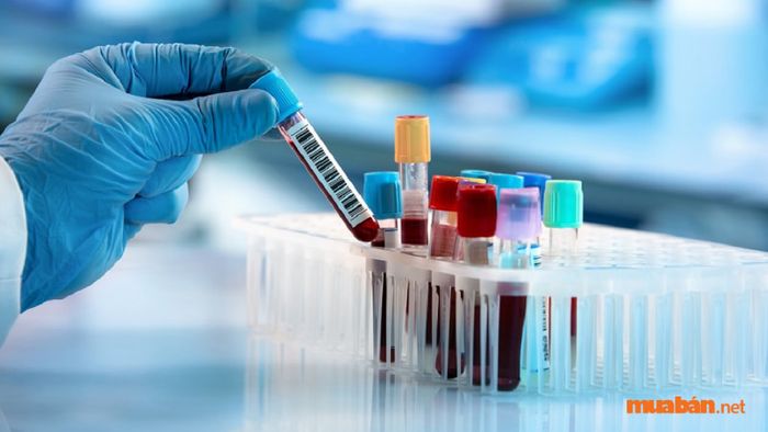 Mức thu nhập của ngành xét nghiệm Y học tại một số vị trí hiện tại