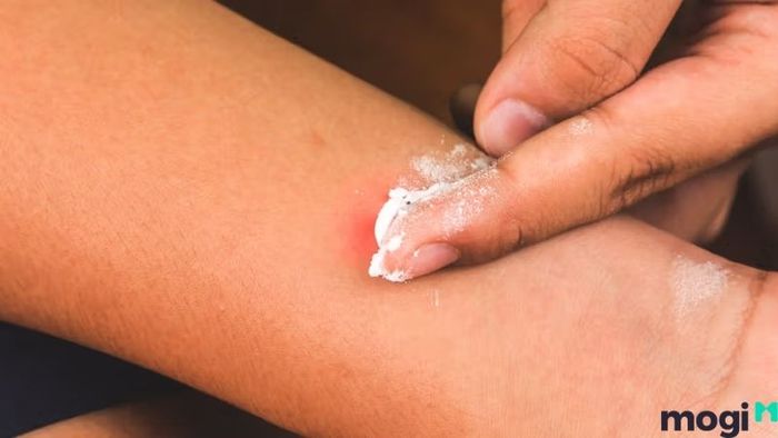 các phương pháp bảo quản baking soda