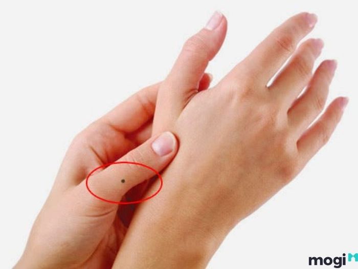 nốt ruồi trên ngón tay