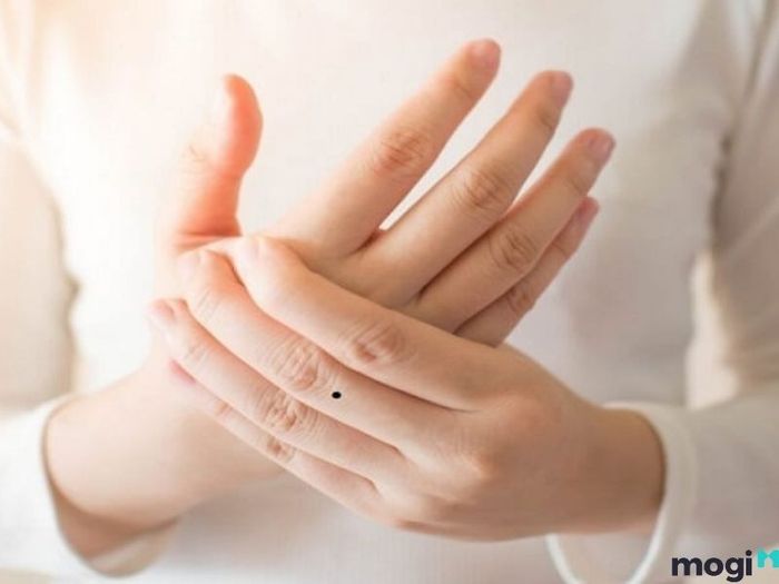 nốt ruồi trên ngón tay
