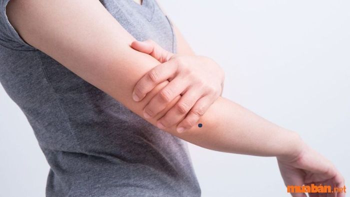 Nốt ruồi ở khuỷu tay phải