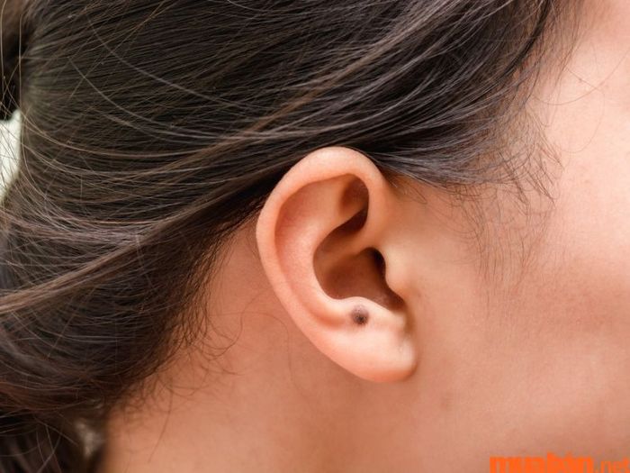 Nốt ruồi ở tai có ý nghĩa gì đối với cuộc đời của bạn?