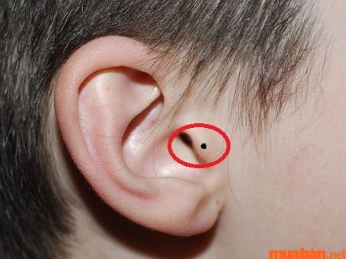 Nốt ruồi ở bình tai của nam giới có ý nghĩa gì?