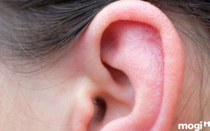 Khô tai là một trong những nguyên nhân gây ra cảm giác ngứa