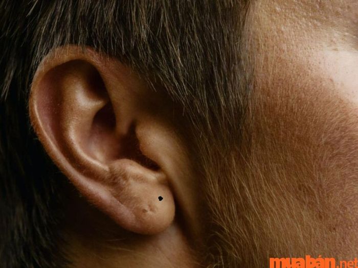 Nốt ruồi ở dái tai nam giới mang ý nghĩa gì?
