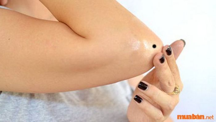 Ý nghĩa của nốt ruồi ở phía ngoài khuỷu tay