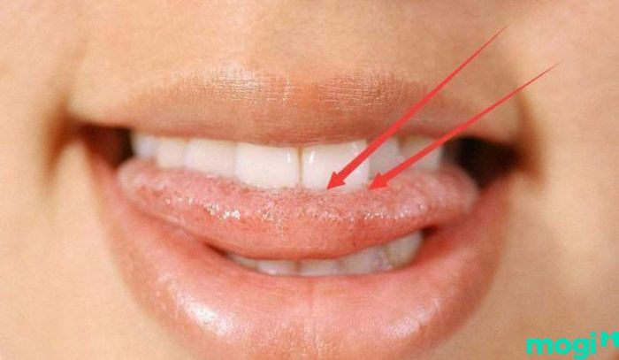 Cắn vào lưỡi là điềm báo gì - Phân tích từ góc nhìn tâm linh