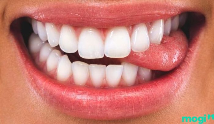 Cắn vào lưỡi có thể nguy hiểm nếu vết cắn sâu hoặc lớn