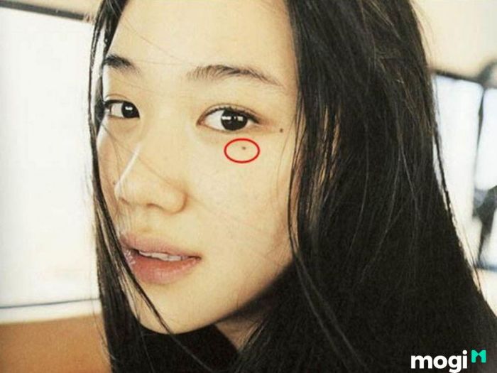 Nốt ruồi lệ có ý nghĩa gì?