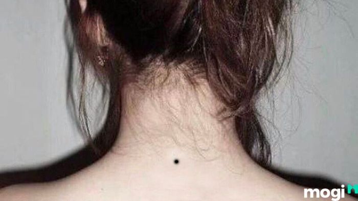 Nốt ruồi phú quý ở sau gáy