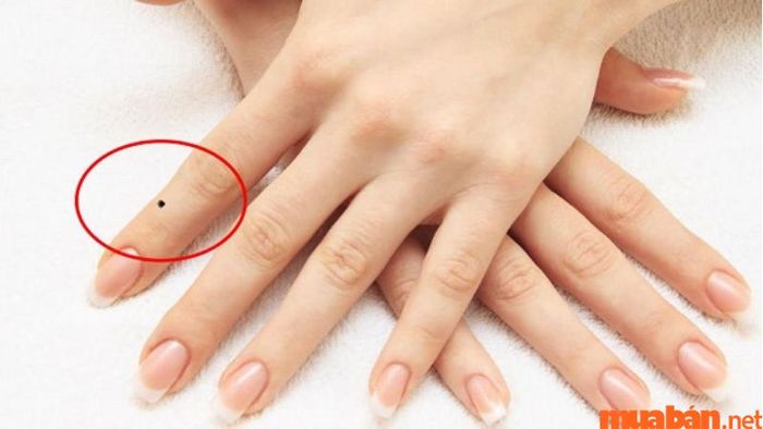 Nốt ruồi phong thủy ở ngón tay: Ý nghĩa và điềm báo