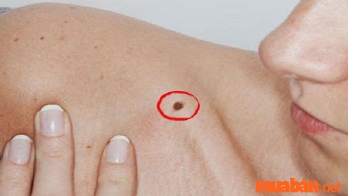 Nốt ruồi ở vị trí gần cuối xương quai xanh - Tướng người sống nghĩa hiệp, giàu tình cảm.
