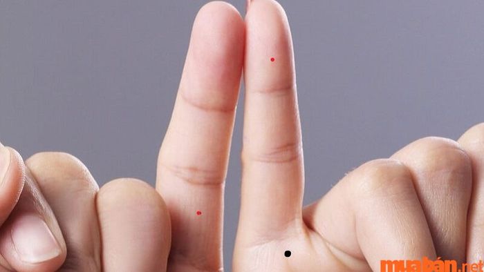 Nốt ruồi trên tay có thể thay đổi