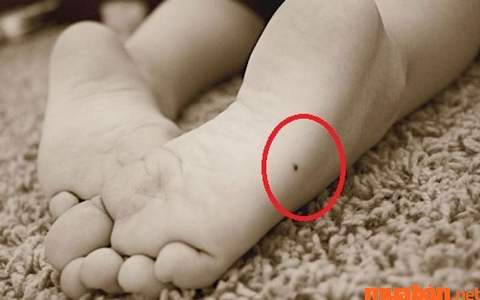 Nốt ruồi ở mép bàn chân cho thấy người này luôn phải vất vả lo toan cho cuộc sống và gia đình, sức khỏe không được tốt.