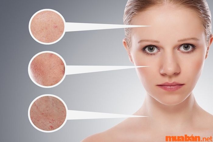 Therapist cần nắm vững kiến thức cơ bản về các loại da.