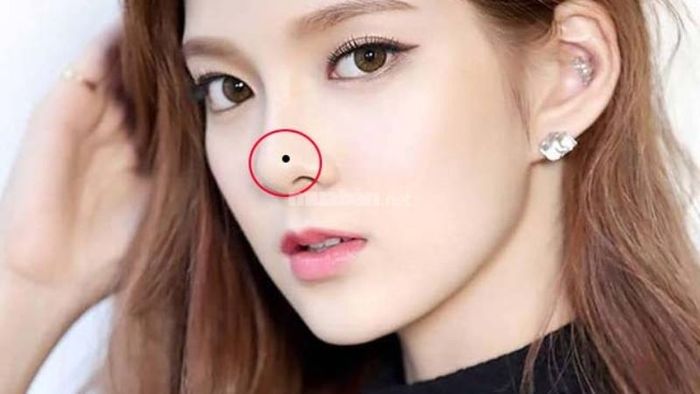 Những nốt ruồi không may mắn trên khuôn mặt
