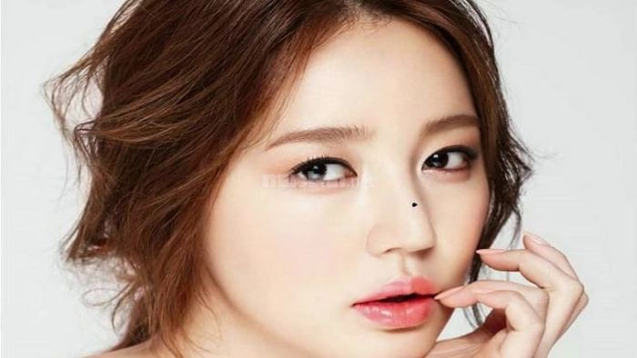 Những nốt ruồi không may mắn trên khuôn mặt
