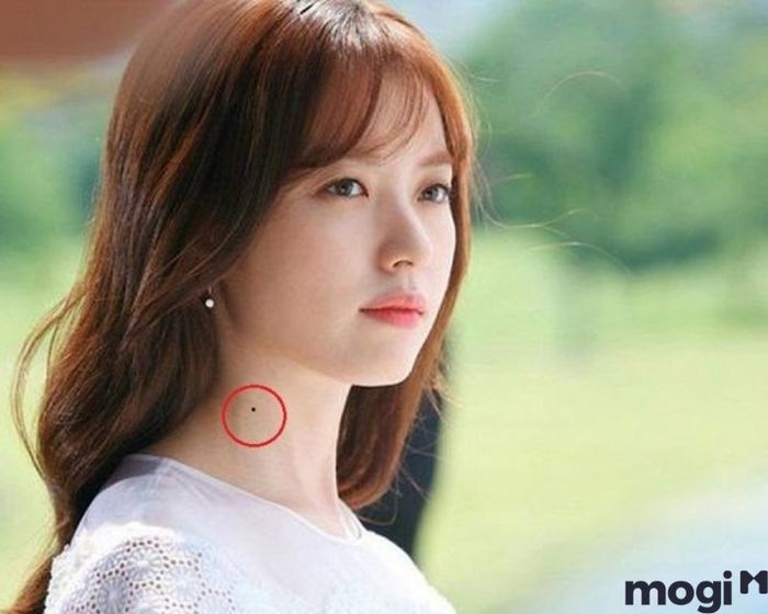 Nốt ruồi ở cổ thường mang đến vận may cho người sở hữu chúng.