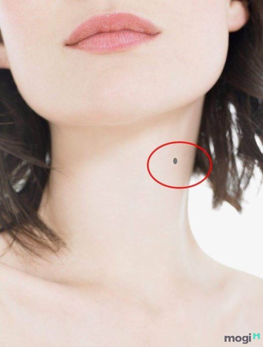 Nốt Ruồi Ở Cổ Bên Phải Của Phụ Nữ