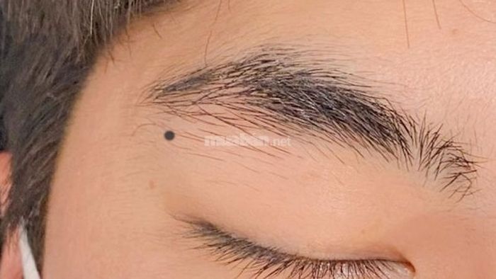 những nốt ruồi xui xẻo trên mặt