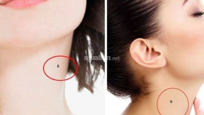Những nốt ruồi xui xẻo trên mặt