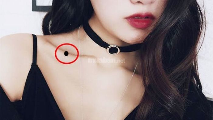 Những nốt ruồi xui xẻo trên mặt