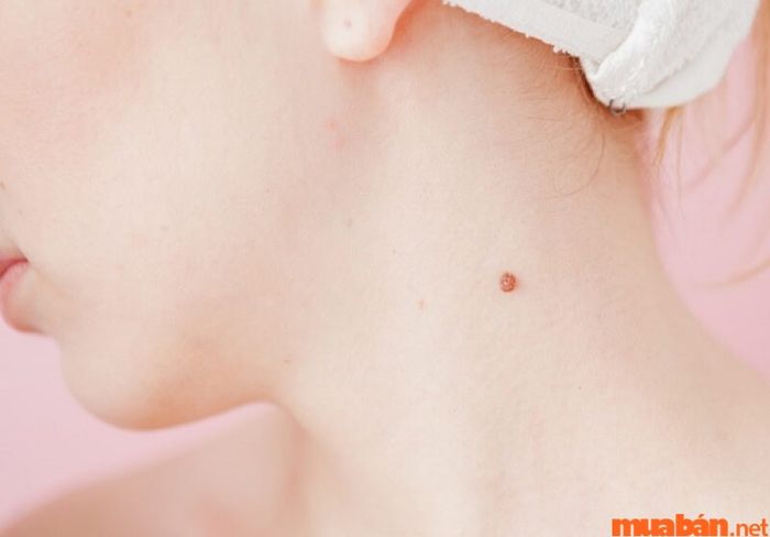 Nốt ruồi sau gáy gần cổ mang lại tài lộc và tiền bạc dồi dào.