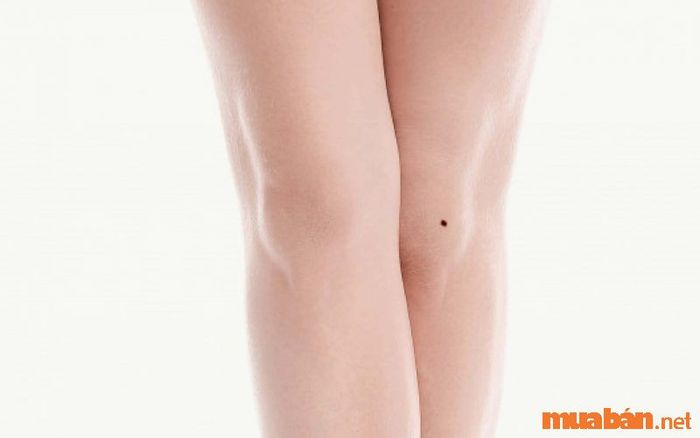 Nốt ruồi ở đầu gối trái của phụ nữ