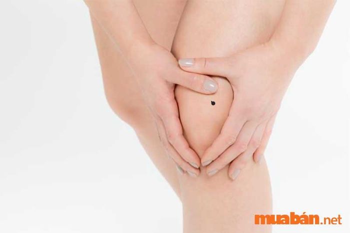 Giải mã ý nghĩa của nốt ruồi ở đầu gối